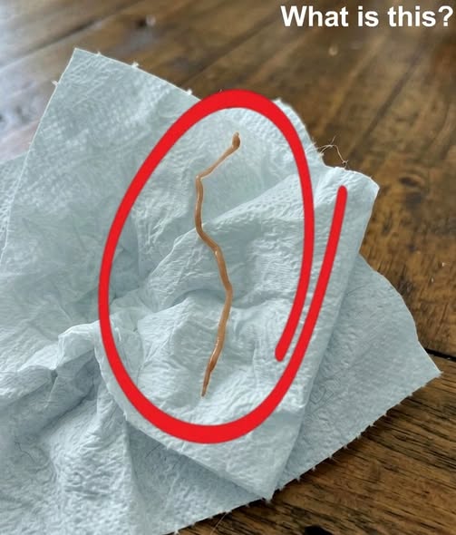 I FOUND A WRITHING PARASITE IN MY DINNER AND ALMOST VOMITED UNTIL I LOOKED CLOSER