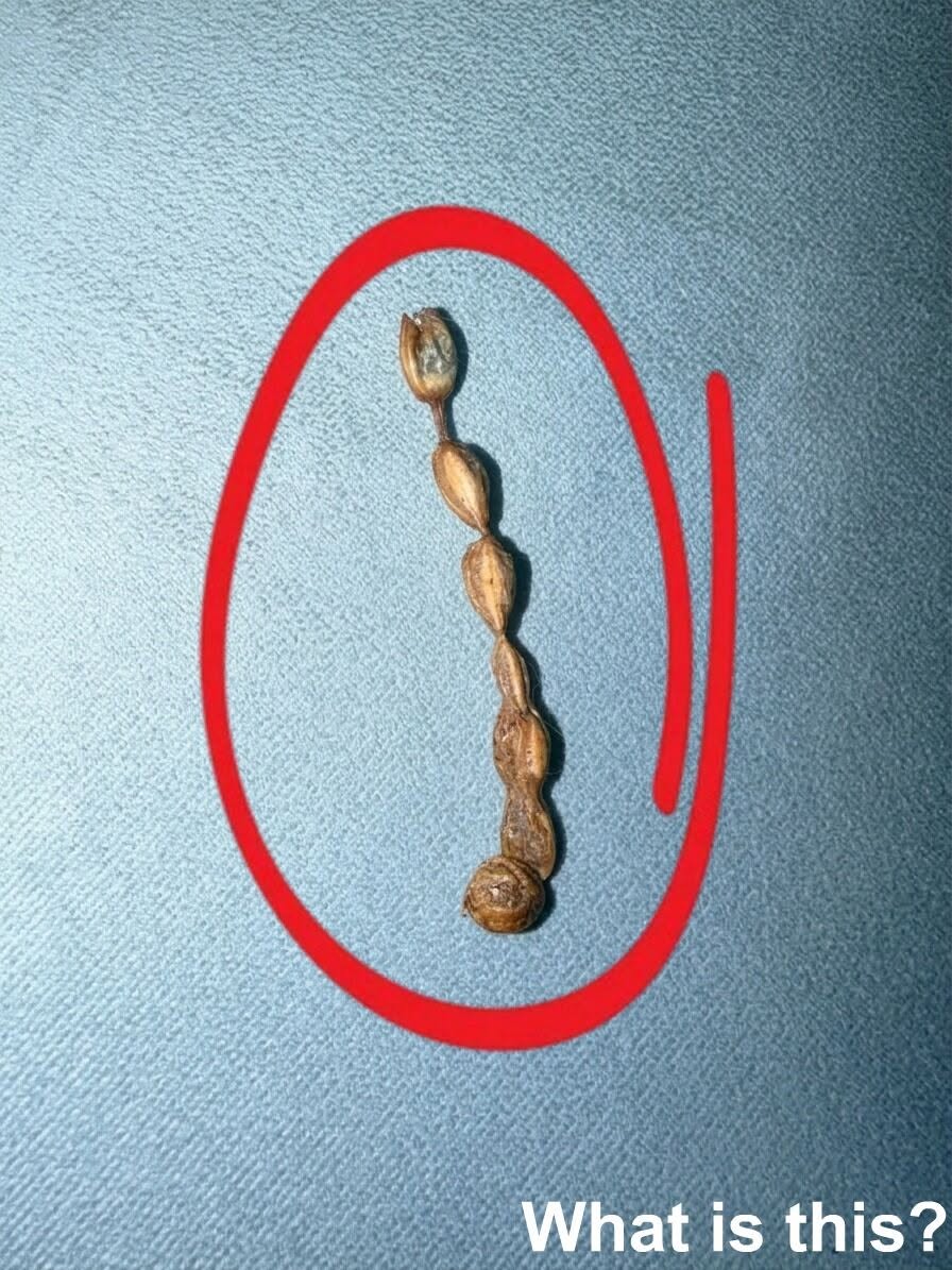 I found this on my couch. It looks kind of cr℮epy. I’ve been staring at it for an hour and still can’t figure out what it is