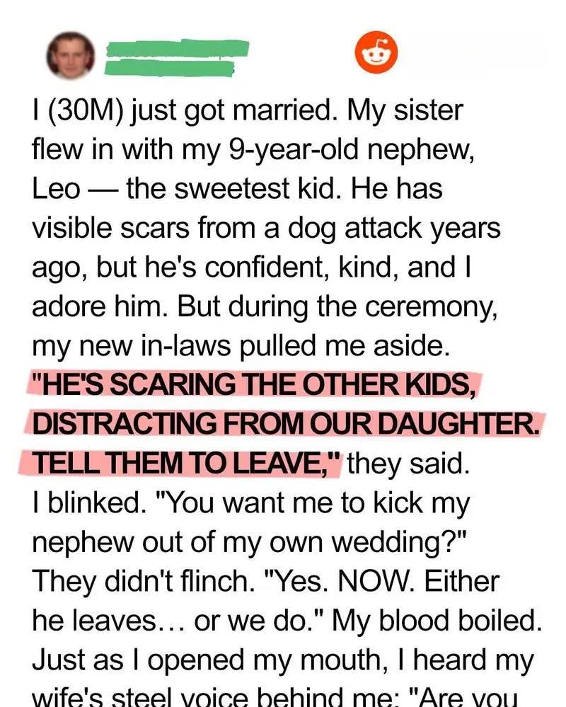 My In-Laws Tried to Ban My Scarred Nephew from Our Wedding — My Wife’s Response Left Them Speechless