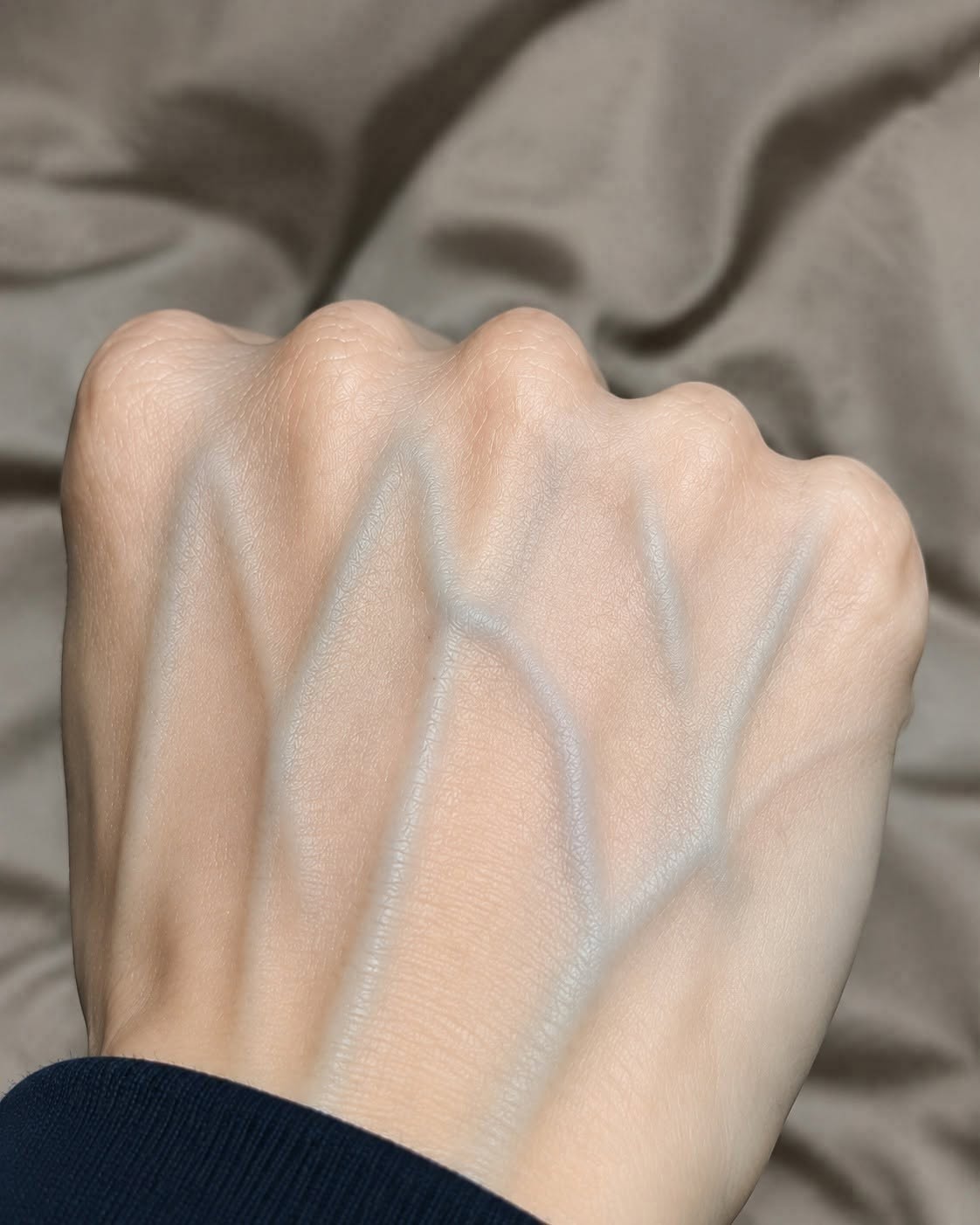 Your Visible Veins Could Be A Deadly Warning Sign You Must Not Ignore