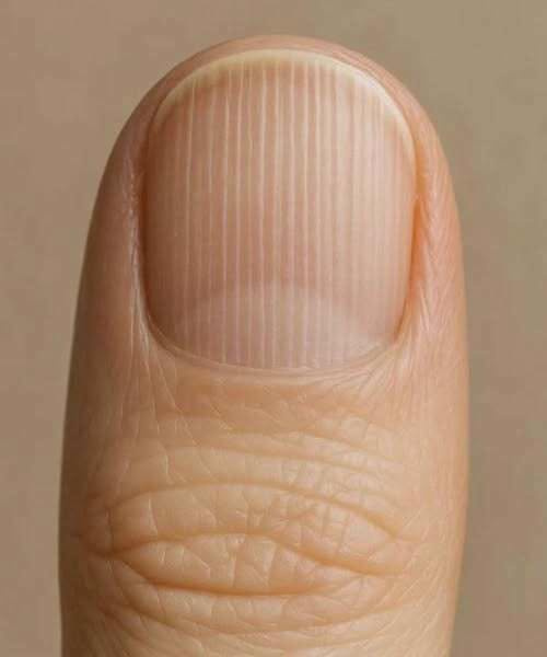 Your Fingernails Are Trying to Warn You of a Hidden Danger, But You’re Ignoring the Most Critical Clues