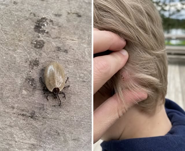 What Kind of Bug Is That? A Parent’s Guide to an Unusual Insect Found on a Child’s Scalp