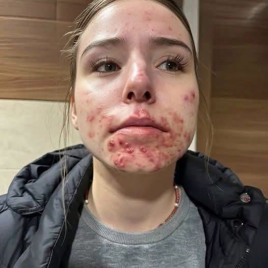 These are the consequences of sleeping with a See more